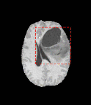 Artificial Brains: Synthetic Brain MRI Generation