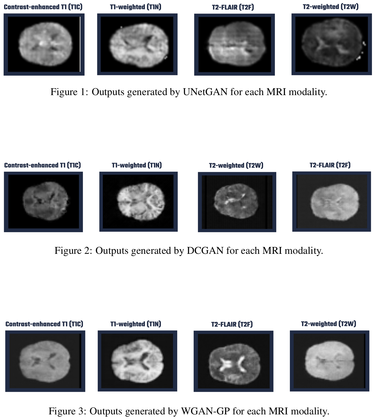 Synthetic MRI Generation using UNetGAN, DCGAN, WGAN-GP